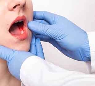 A dentist assessing a woman’s infected gums